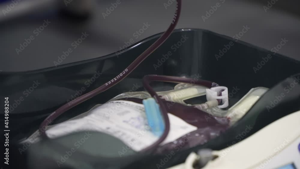 A bag of blood is on a scale during the donation, whose blood is shaken to mix it with the