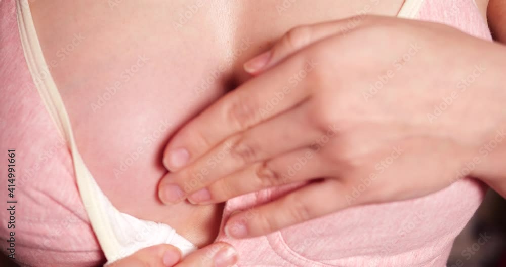 reddened breast feeding mothers. Close-up of a girl's breast suffering from mastitis or lactostasis. slow motion reddened breast feeding mothers. Close-up of a girl's breast suffering from mastitis or lactostasis. slow motion