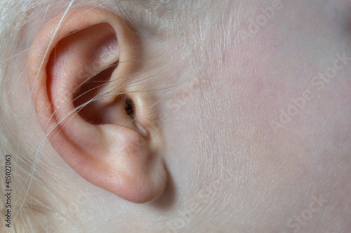 woman's ear close-up. healthcare and deafness concept photo