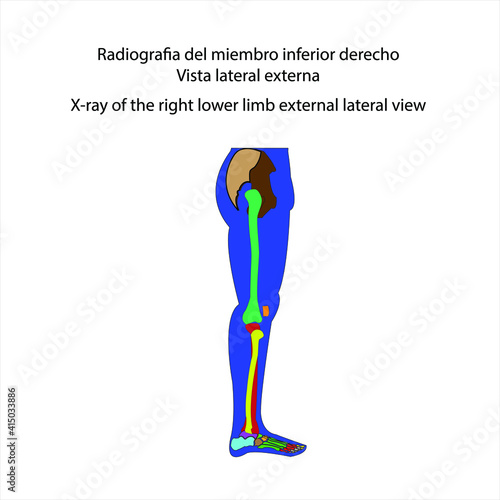 Esqueleto humano radiografía del miembro inferior derecho vista lateral externa