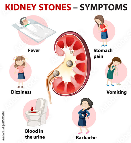 Kidney stones symptoms cartoon style infographic