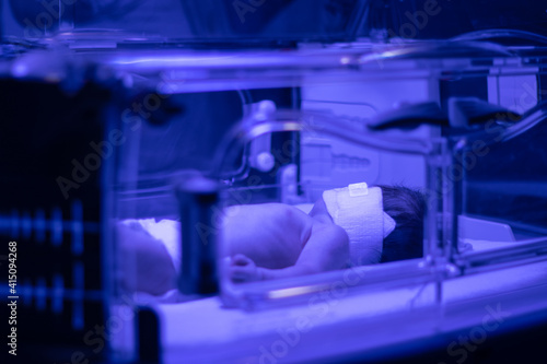Newborn baby under ultraviolet lamp is getting treated for jaundice (elevated bilirubin) in Vancouver hospital photo