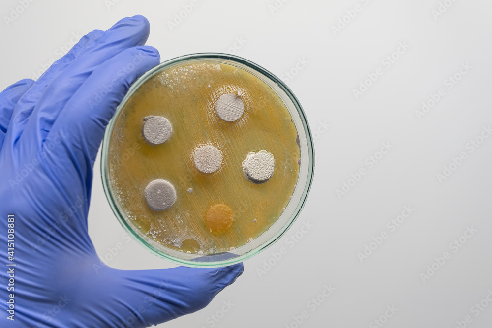 The scientist holds with his hand in a blue glove a Petri dish with columns on the antagonism of bacteria. Microbiological experiment with bacteria in a Petri dish. The scientist holds with his hand in a blue glove a Petri dish with columns on the antagonism of bacteria. Microbiological experiment with bacteria in a Petri dish.