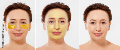 Macro female face before after beauty treatment. Middle aged woman. Beauty portrait of middle age women with wrinkles and a gold patch under eye, face mask. Collagen mask, spa concept. Summer skincare