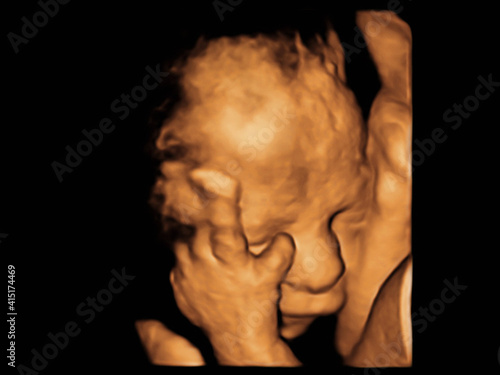 image Ultrasound 3D, 4D of baby in mother womb.