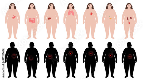 Organs in obese human body