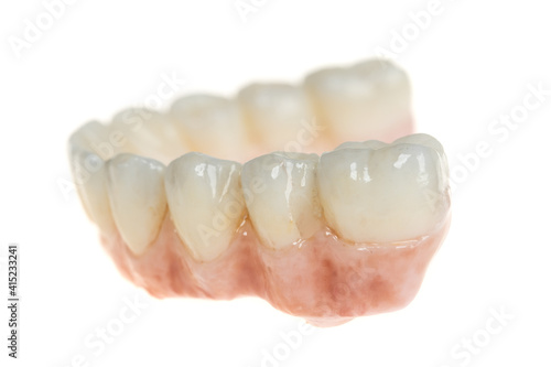 Dental health care. Ceramic zirconium in final version. Close up dental prosthesis on zirconium oxide implants, isolated on white. Side view