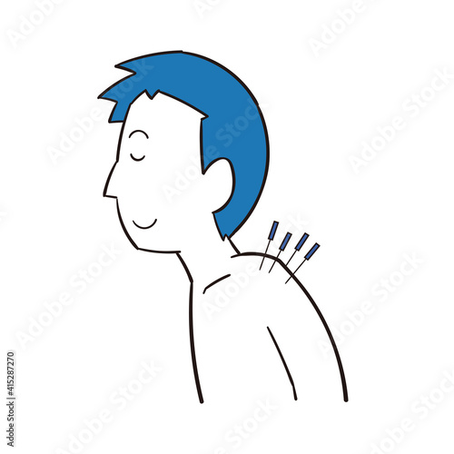 肩を鍼治療する男性