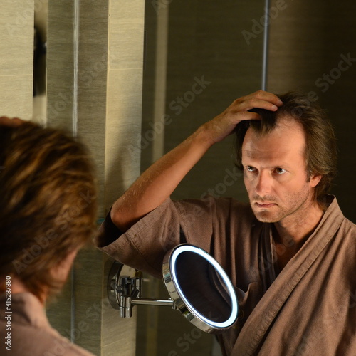 Hair loss issue, alopacia