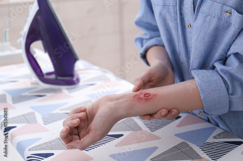Woman with burn on her forearm near ironing board at home, closeup