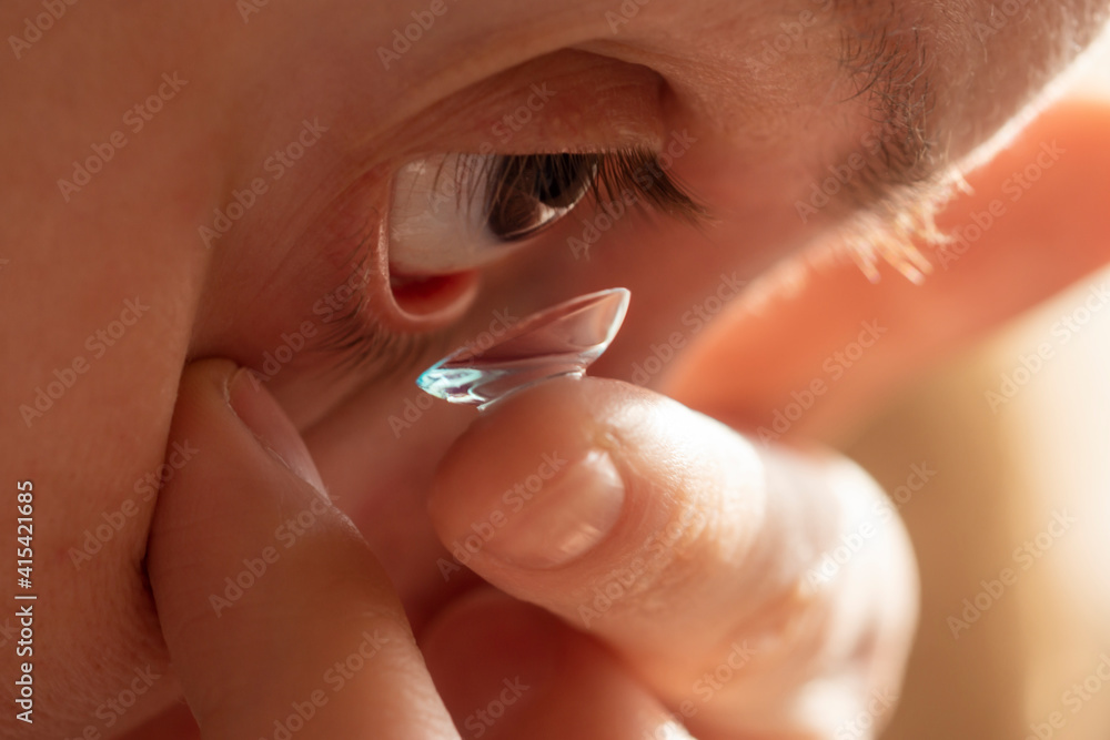 Fototapeta premium A person with poor eyesight inserts a contact lens into her eye in sunny morning