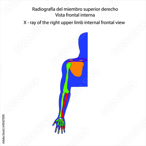 Esqueleto humano radiografía del miembro superior derecho vista frontal interna vector ilustración
