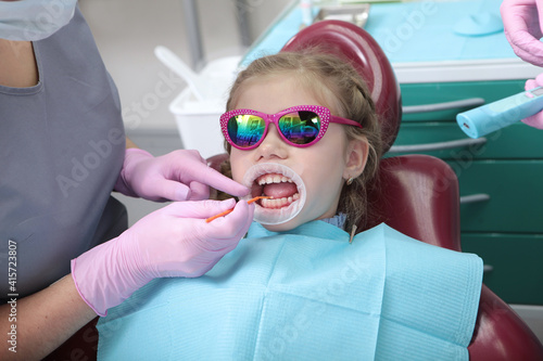 A little girl at a dentist appointment. Professional dental hygiene. Prevention of dental caries. A child wearing safety glasses. photo