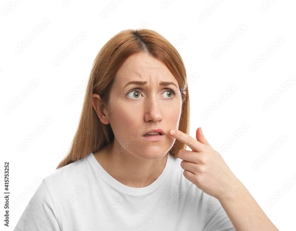Upset woman suffering from herpes on white background Upset woman suffering from herpes on white background