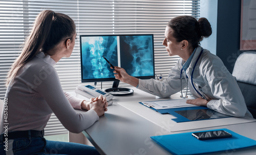 Doctor checking a patient's x-ray of spine photo