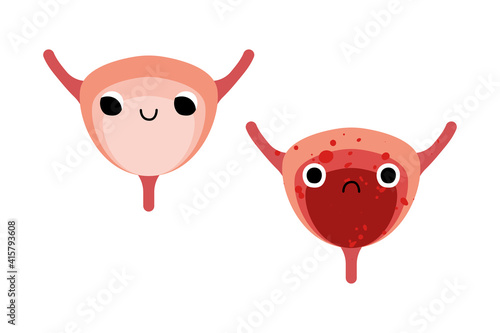 Cute bladders characters with smiling and sad face. Funny kawaii human internal organ with eyes. Healthy and illness insides, bladder disease. Urology. Vector flat cartoon illustration