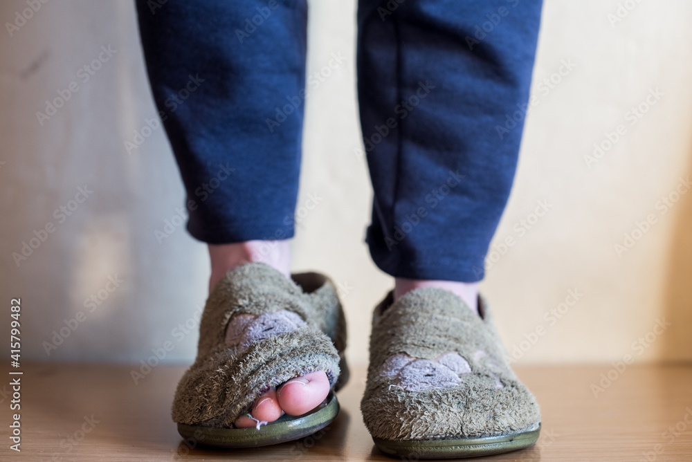 Una mujer joven usando dos pantuflas de casa muy gastadas, rotas y muy usadas enseñando los dedos de sus pies por la parte de delante. Zapatillas de andar por casa de mujer o niña con agujeros. 