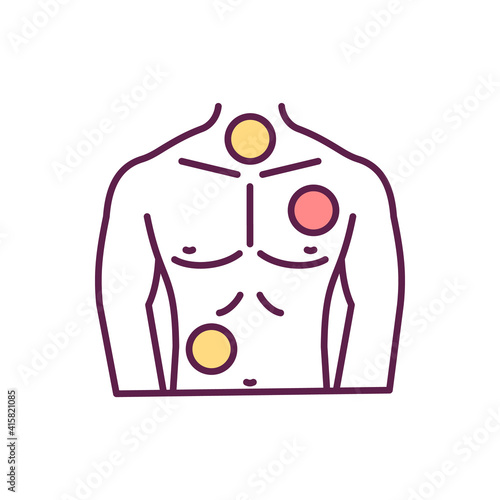 Cancer cells development in body RGB color icon. Patient with widespread metastasis. Unchecked cell growth. Forming solid tumors. Cancer spreading to tissues and organs. Isolated vector illustration