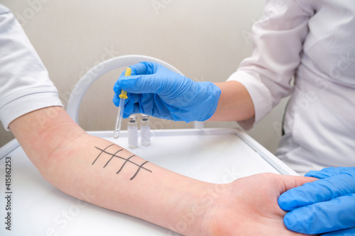 Immunologist Doing Skin Prick Allergy Test. photo
