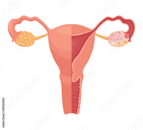 Realistic flat vector illustration of woman reproductive system. Human internal organ, uterus, ovary, the fallopian tubes. Ovulation process: follicle, ovum, corpus luteum, corpus albicans.