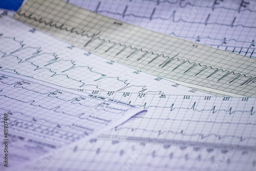 Electrocardiogram strips with cardiac arrhythmias. Acute myocardial infarction. Selective focus on some beats. Free space to write. photo