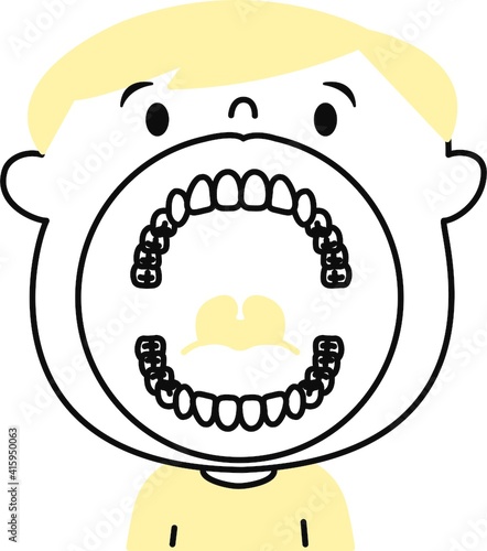 子供　歯列　口の中　イラスト