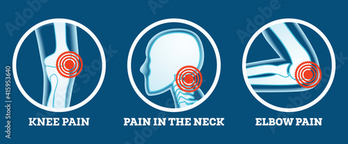 Body Pain. Icons Set. Pain in Knee, Neck and Elbow. Woman's and Man's Body Parts.