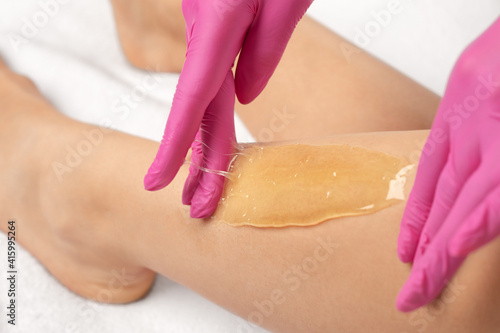 Obraz na plátně A beautician makes a sugar paste depilation of a woman's legs in a beauty salon