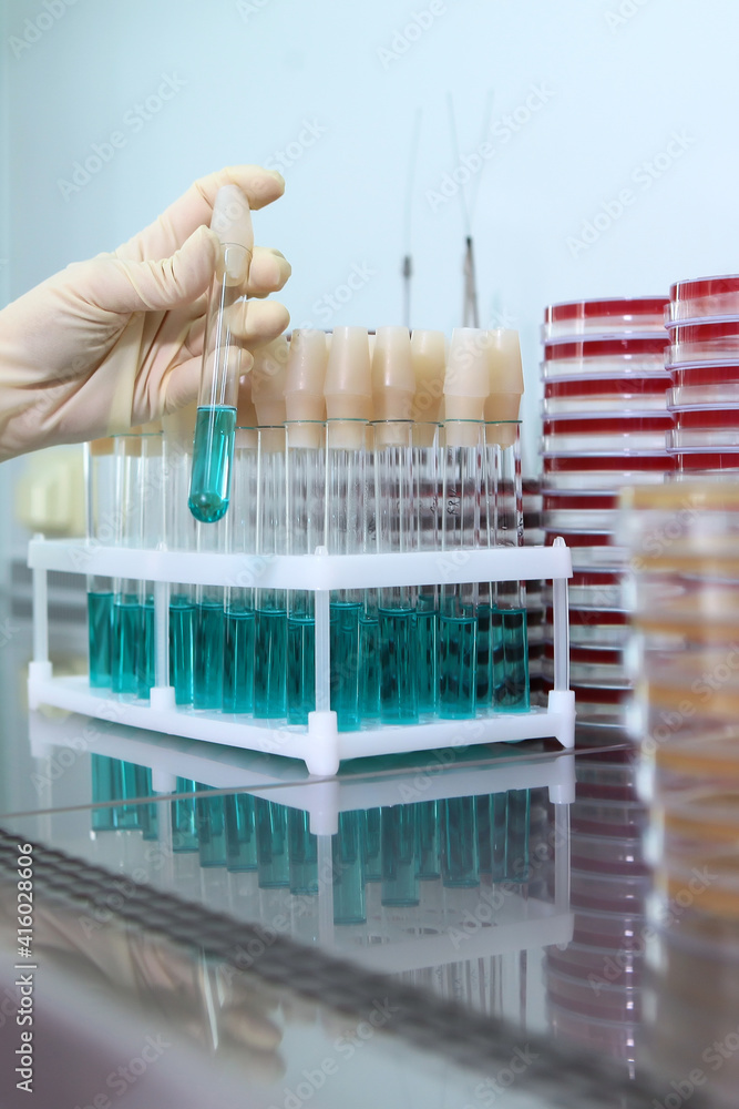 Development of a new vaccine. A vaccine against Covid 19. Clinical and diagnostic laboratory. An unrecognizable person. Only hands with protective gloves.Coronavirus infection. Development of a new vaccine. A vaccine against Covid 19. Clinical and diagnostic laboratory. An unrecognizable person. Only hands with protective gloves.Coronavirus infection.