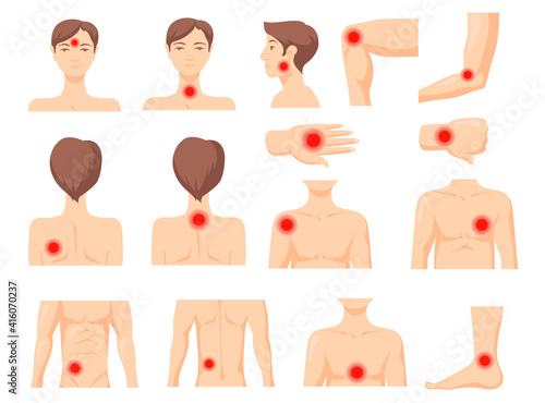 Focus of pain set. Parts of human body with red spot, ache in muscles or joints. Vector illustration for inflammation, chronic disease, painkiller, health problem concept