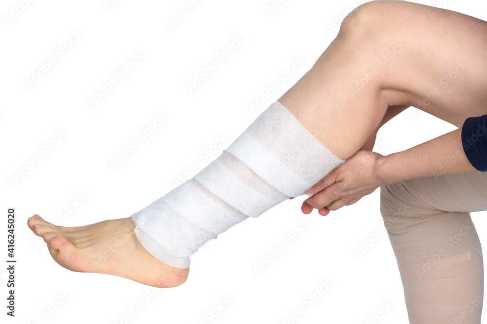 Lymphedema management Wrapping Lymphedema leg using multilayer