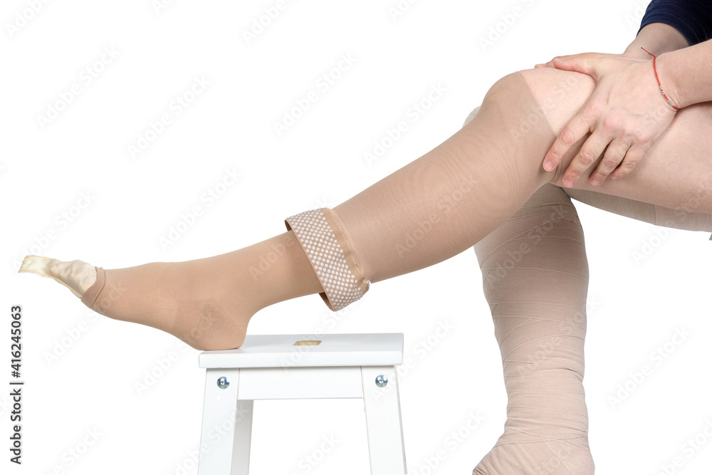 Foto de Compression garments for the treatment of lipoedema and lymphoedema. Lymphedema management: Wrapping leg using multilayer bandages to control  Lymphedema. Part of complete decongestive therapy (cdt do Stock
