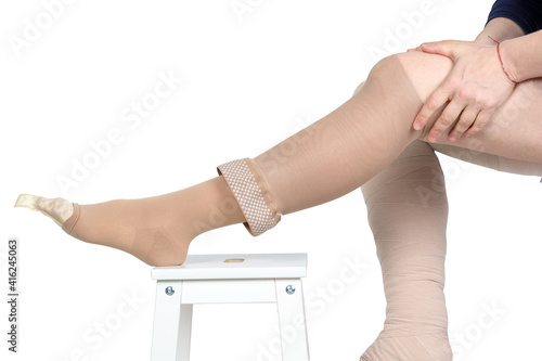 Tela Compression garments for the treatment of lipoedema and lymphoedema