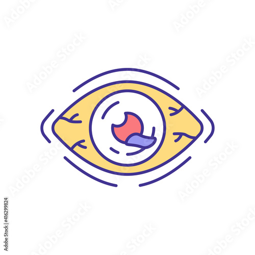 Eye injury RGB color icon. Foreign objects penetrating in eye. Vision loss, blindness. Chemical exposures. Punctured eyeball. Glaucoma, cataract. Change in vision. Isolated vector illustration