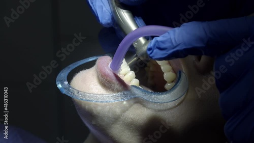 teeth alignment in the clinic