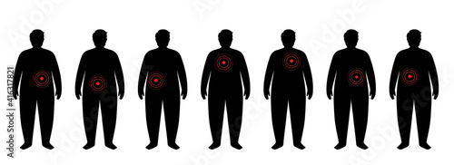 Organs in obese human body