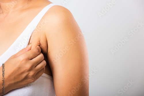 Close up of Asian woman pulling excess fat on her skin underarm she problem armpit fat underarm wrinkled skin, studio isolated on white background, Healthy overweight excess body concept photo