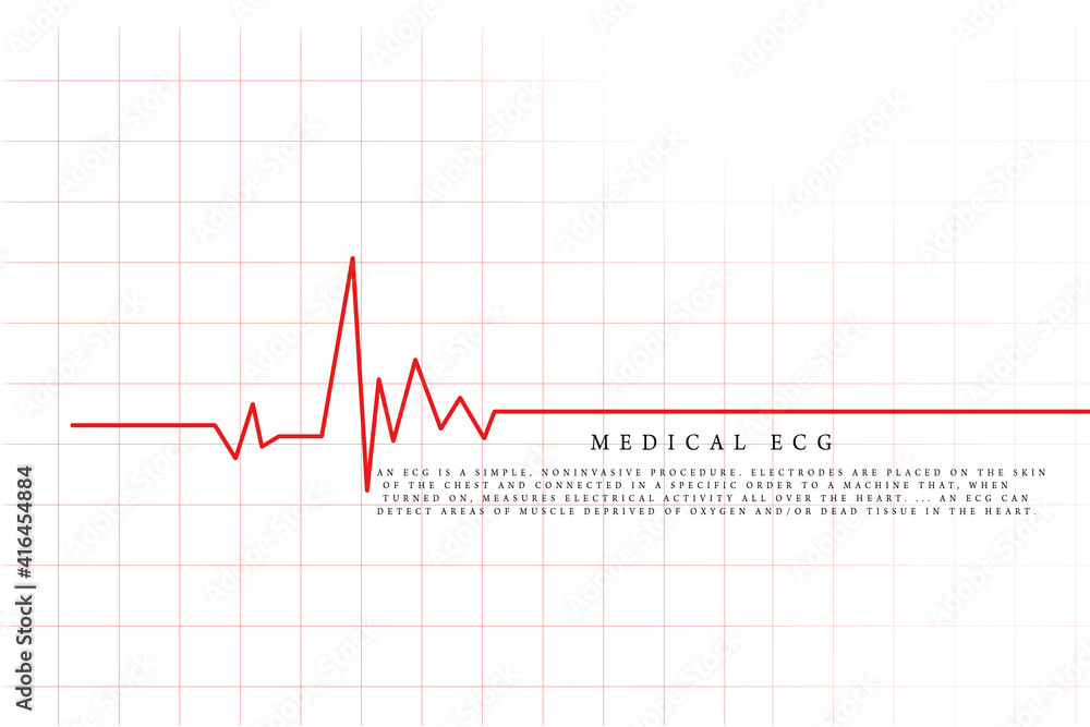 Heart with cardiogram - 2D illustration