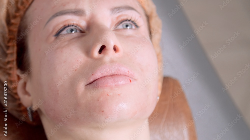 Head of a female patient in a protective medical cap, woman looks up at the doctors. Portrait of a tired woman lying on a medical couch, close-up. Head of a female patient in a protective medical cap, woman looks up at the doctors. Portrait of a tired woman lying on a medical couch, close-up.