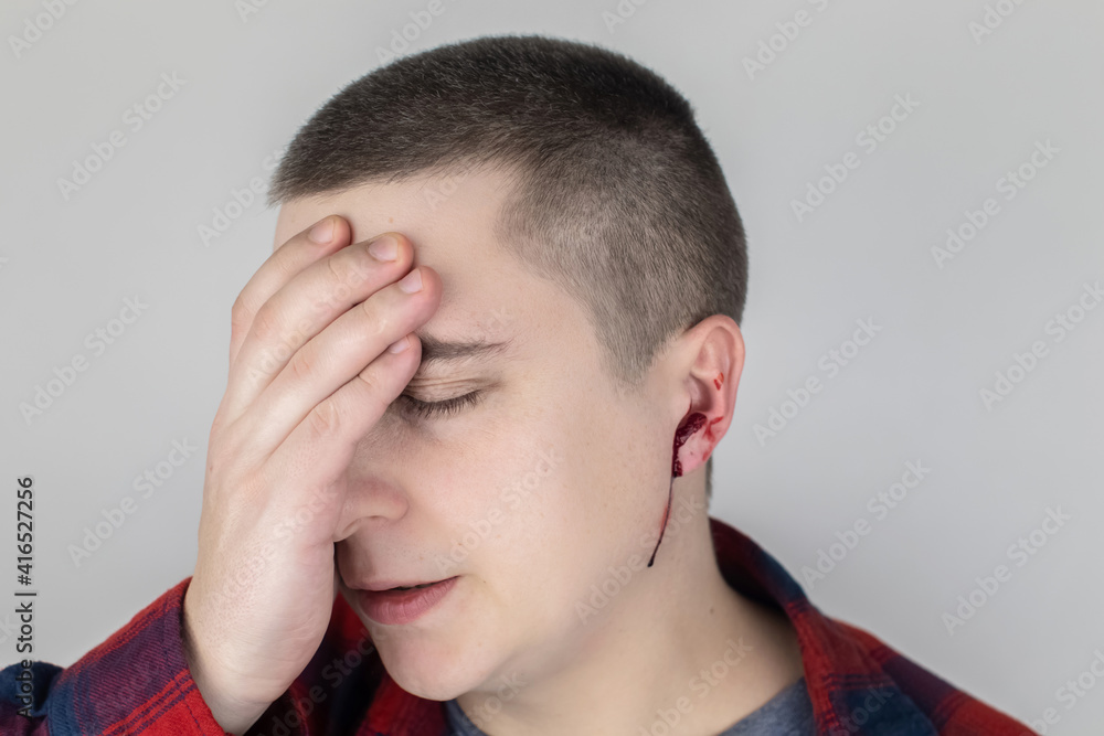 Fototapeta premium A man whose ear is bleeding. Vascular rupture, damage to the tympanic membrane, ear diseases, oncology, otitis media, myringitis