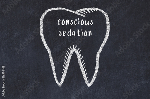 Obraz na plátně Chalk drawing of a tooth with medical term conscious sedation