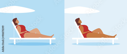 Plus size woman on sun lounger, tanning on light skin, flat vector stock illustration as sunburn progress concept, tan, tanning, summer suntan