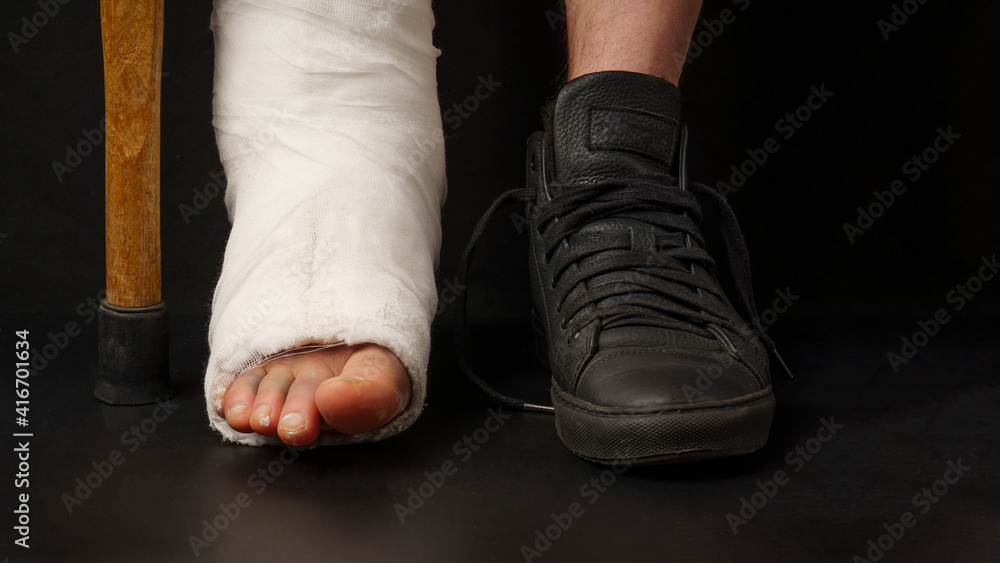 Young man with a broken ankle and a white bandage on his leg after an accident due to weather conditions,