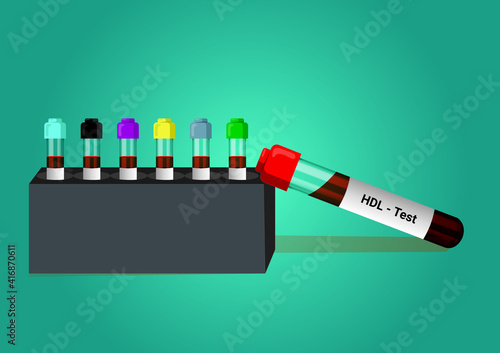 Blood sample for HDL (High-density lipoprotein) test. Lipid profile. Good Cholesterol. The medical testing concept with a doctor vector in the laboratory background.