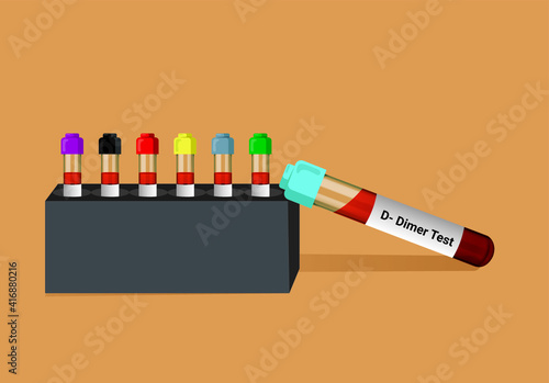 Blood sample for D-Dimer test. Corona patient monitoring test in ICU. Deep venous thrombosis. A medical testing concept with tube vector in the laboratory background.