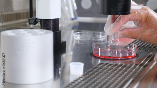 Foto Close-up of the IVF procedure
