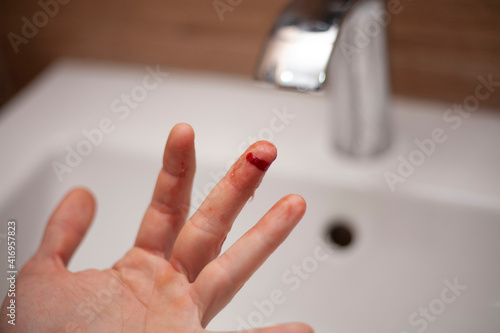The man cut his finger. A cut. Blood flows from the finger