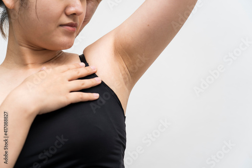 Close up of female asia with armpit plucking problem. ,female hairy armpit. Model touching her axilla. Surgery or health care, beauty and female concept