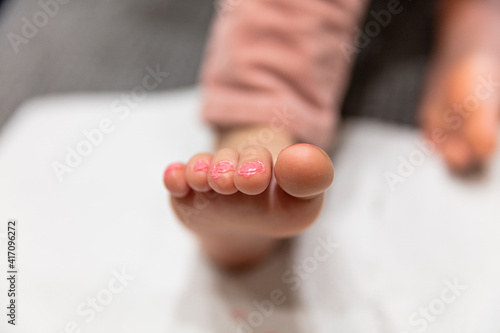Child's Foot with Home Pedicure Painted Toenails © Nektarstock