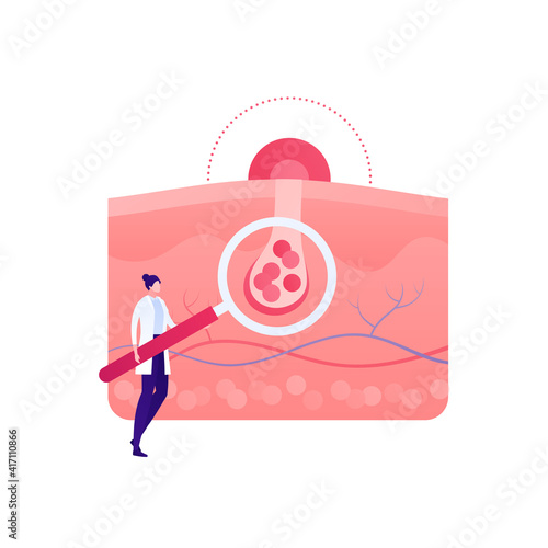 Dermatology and skin health care concept. Vector flat modern illustration. Dermatologist doctor female character hold magnifier glass on skin scheme. Mole, cancer, allergy, acne analysis symbol.